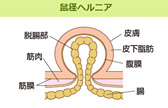 脚のつけ根にできたしこり。どのような病気が考えられる？
