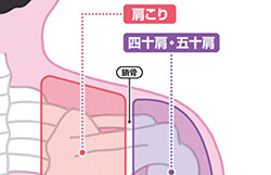 肩こり・四十肩…　[最新版]肩トラブルの解消法